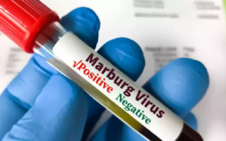 Египет подтвердил отсутствие вируса Марбург в стране